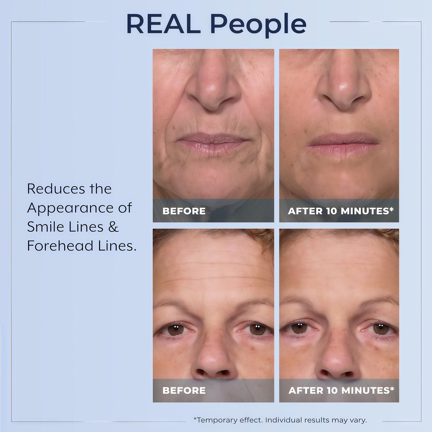 Plexaderm Rapid Reduction Serum - Visibly Reduces Under-Eye Bags & Wrinkles | Instant eye serum that visibly reduces under-eye bags, puffiness, wrinkles & dark circles in minutes, lasting up to 10 hours