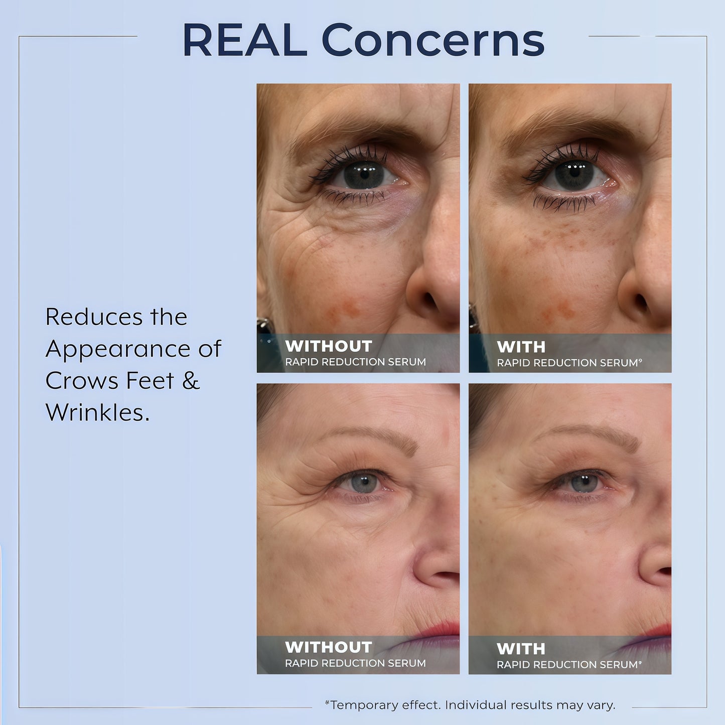 Plexaderm Rapid Reduction Serum - Visibly Reduces Under-Eye Bags & Wrinkles | Instant eye serum that visibly reduces under-eye bags, puffiness, wrinkles & dark circles in minutes, lasting up to 10 hours