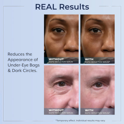 Plexaderm Rapid Reduction Serum - Visibly Reduces Under-Eye Bags & Wrinkles | Instant eye serum that visibly reduces under-eye bags, puffiness, wrinkles & dark circles in minutes, lasting up to 10 hours